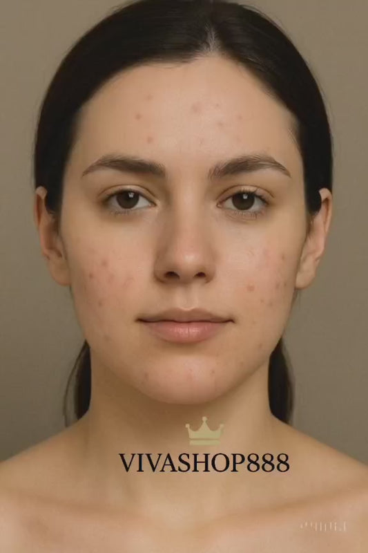 Crema generadora Intensiva aclara manchas,reduce cicatrices y combate el acné.Con Nicotinamide